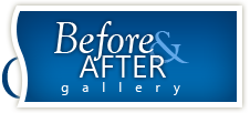 Before & After Gallery